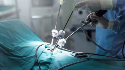 Laparoscopic Gynecological