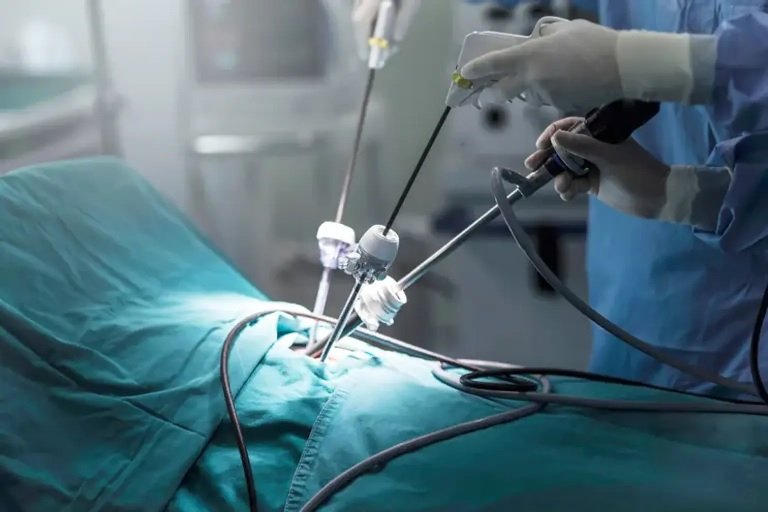 Laparoscopic Gynecological