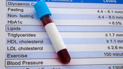 What Is Good Cholesterol