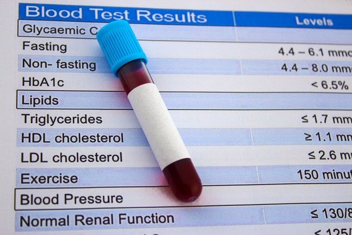 What Is Good Cholesterol